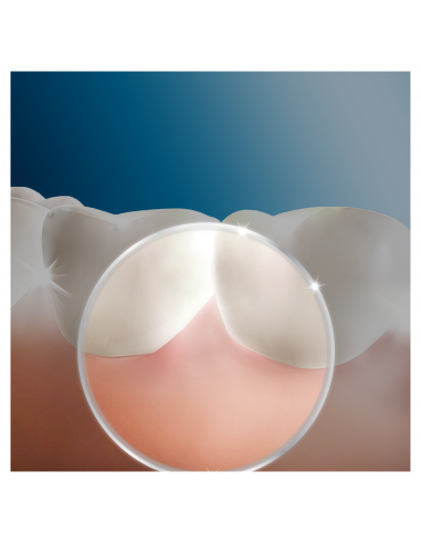 oral-b-oxyjet-md20-2000-irrigador-bucal-6.jpg